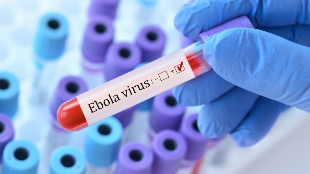 Ebola outbreak in Congo raises global alarm, with American doctor listed among those infected